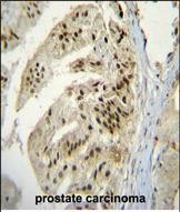 IHC-P - PAP Antibody (Center) AP11691c